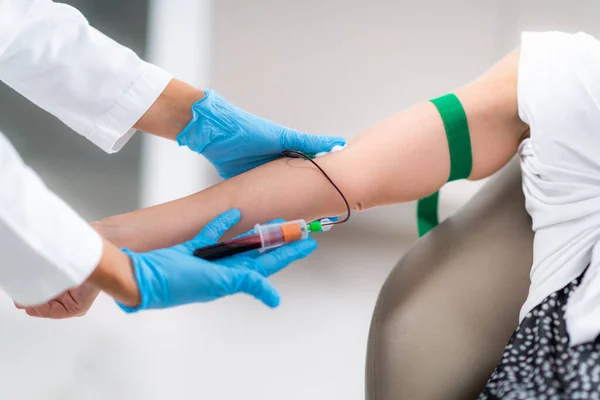 Prp Treatment Drawing Blood Platelet Rich Plasma Injection Aesthetic Medicine — Stock Photo, Image