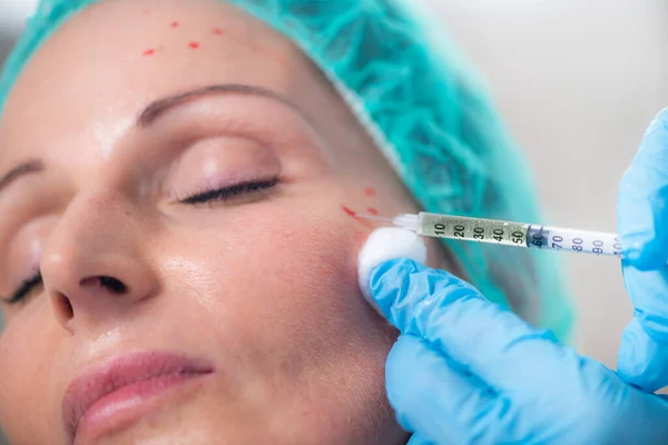 Prp Aesthetic Medicine Face Injection Treatment — Foto Stock