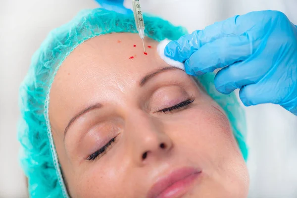 Prp Face Injection Mid Aged Woman Receives Platelet Rich Plasma — Stock Photo, Image