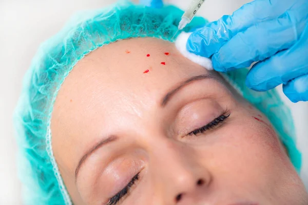Prp Face Injection Mid Aged Woman Receives Platelet Rich Plasma — Stock fotografie