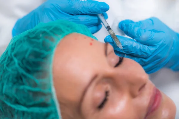 Prp Aesthetic Medicine Face Injection Treatment — Stockfoto