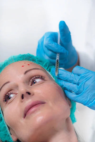 Aging Prp Aesthetic Medicine Facial Treatment — Foto Stock