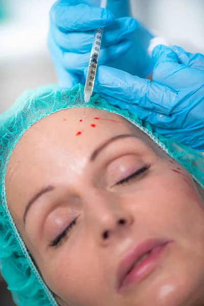 Prp Face Injection Mid Aged Woman Receives Platelet Rich Plasma — Stock Photo, Image