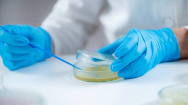Microbiology researcher working in a laboratory, using an inoculation rod to spread out culture with bacteria onto a nutritional agar in a Petri dish 