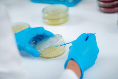 Microbiology lab work in a research facility. Hands of a lab technician spreading bacterial culture over the nutritional agar 