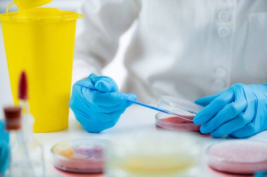 Microbiology laboratory work. Hands of a microbiologist working in a biomedical research laboratory, using a disposable inoculation rod to inoculate blood agar in a Petri dish.  