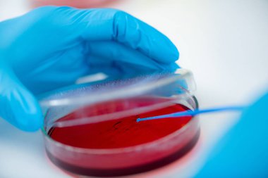 Microbiology laboratory work. Hands of a microbiologist working in a biomedical research laboratory, using a disposable inoculation rod to inoculate blood agar in a Petri dish.  