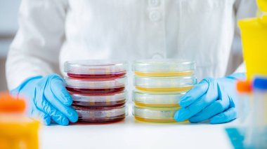 Microbiologist preparing bacterial cultures in a research laboratory, holding Petri dish stacks with bacteria cultures spread over nutritional and blood agar surfaces.  