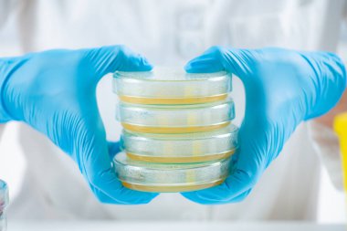 Microbiology. Hands of a microbiology lab technician holding a stack with Petri dishes containing bacterial cultures spread over nutritional agar. 