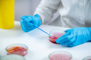 Microbiology laboratory work. Hands of a microbiologist working in a biomedical research laboratory, using a disposable inoculation rod to inoculate blood agar in a Petri dish.  
