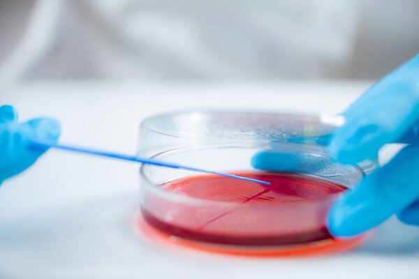 Blood agar inoculation. Microbiologist working in a biomedical research laboratory, using inoculation rod and Petri dish. 