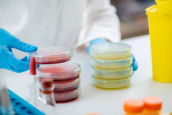 Microbiologist preparing bacterial cultures in a research laboratory, holding Petri dish stacks with bacteria cultures spread over nutritional and blood agar surfaces.