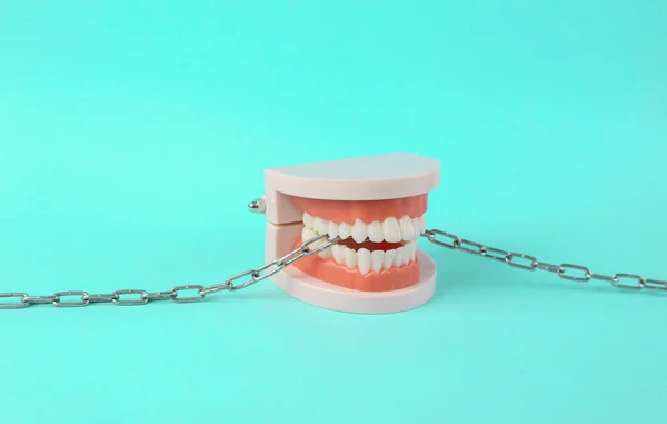 Strong Healthy Teeth Plastic Model Human Jaw Gnaws Steel Chain — Stock Photo, Image