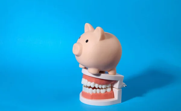 Plastikmodell Eines Menschlichen Kiefers Mit Sparschwein Auf Blauem Hintergrund — Stockfoto
