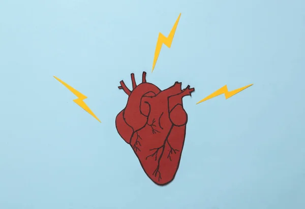 Hjärtsjukdomar Papper Hjärta Med Gnistor Blå Bakgrund Kreativ Utformning — Stockfoto