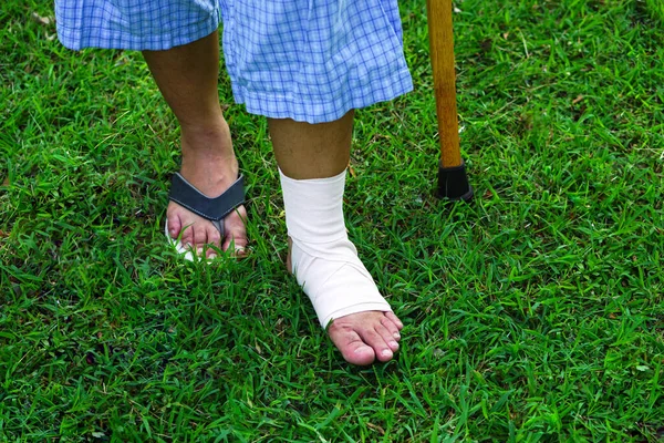 Das Bild Zeigt Patienten Mit Knöchelverletzungen Mit Bandagen Und Krücken — Stockfoto