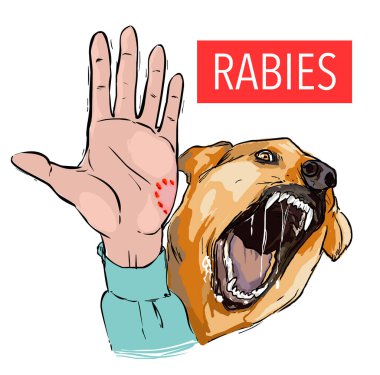 Köpek ısırığı, hasta hayvan, kuduz virüsü