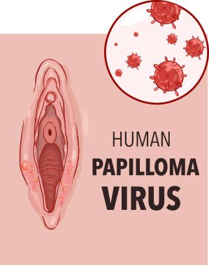  insan papilloma virüsü kadın üreme organları üzerinde vektör çizim