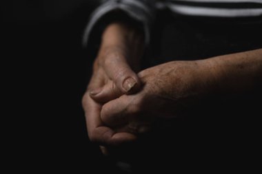 Büyükbabanın yorgun elleri siyah beyaz fotoğraflarla gösteriliyor. Buruşuk deri ve çürük tırnaklar. oncept: portre, eller, siyah beyaz fotoğraf
