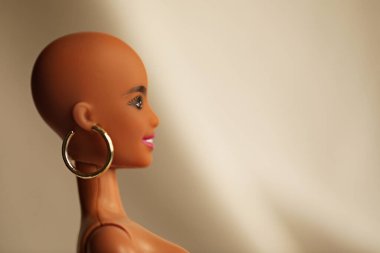 Alopecia. Saçsız bebek kafası. Saç ve vücut sağlığı konsepti.