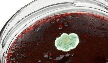 Reçeldeki kalıbı kapat