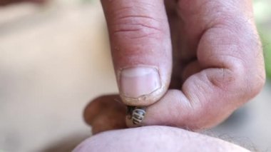 Bee sting in the hand for healing. Medicinal properties of bee venom.