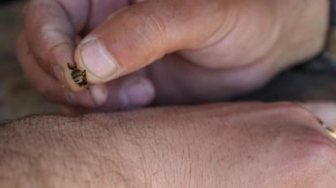 İyileşmek için eline arı sokması. Arı zehrinin tıbbi özellikleri.