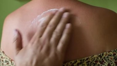 Adam cildine dikkat etmek ve korumak için krem sürüyor. Vücut bakımı. Aşırı güneş yanığı ve cilt tahrişine karşı koruma.