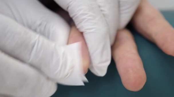 Lekarz Przekłuwa Palec Aby Pobrać Krew Analizy Medycznej Rozpoznawanie Chorób — Wideo stockowe