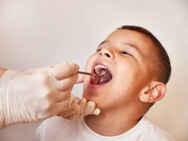 Child Teeth Examined Using Dental Mirror Royalty Free Stock Photos