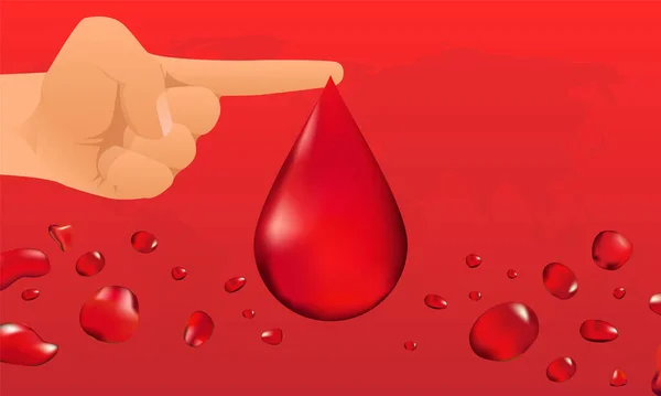 世界血友病日 World Hemophilia Day 是每年4月17日的一个世界血友病日 是一种遗传性出血障碍 血液不能正常凝固 并可能导致自发出血 矢量说明 — 图库矢量图片