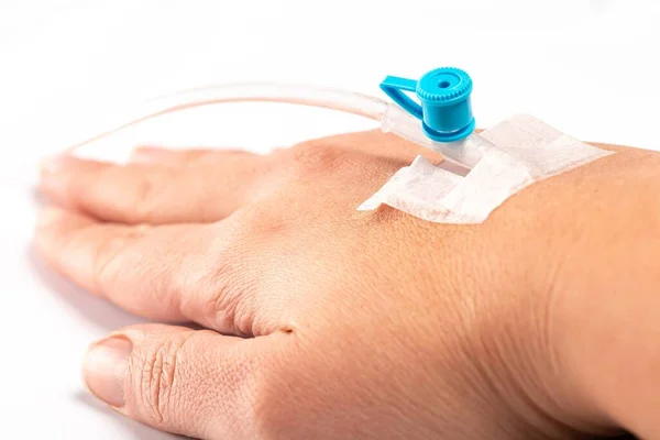 Catheter in a vein in a woman's hand