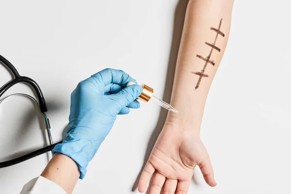 Alerji deri testi ve beyaz arkaplan