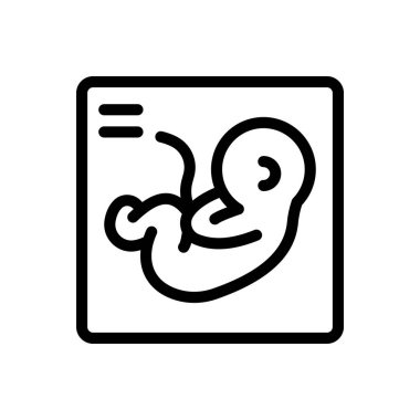 Şeffaf bir arkaplanda ultrason vektör çizimi. Konsept ve grafik tasarımı için ince çizgi simgesi..