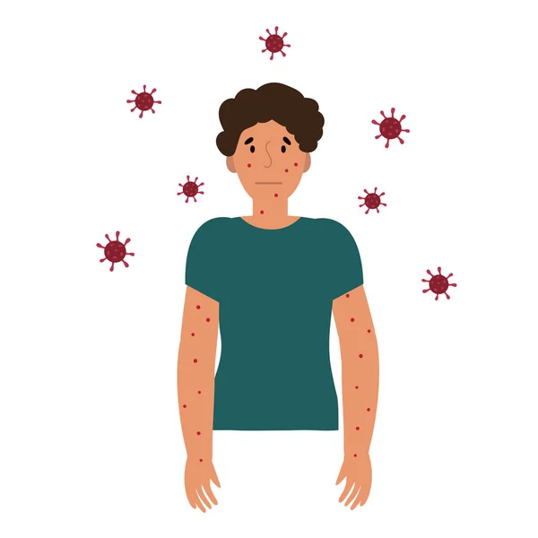 Flat Vector Illustration Man Shirt Blisters Skin Caused Ingestion Monkeypox — Stock Vector