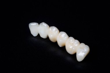 Bir fotoğraf stüdyosunda yapılmış köprü zirkonyum seramik yapısı fotoğrafı
