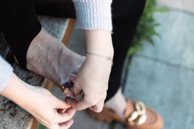 Bir Wooman ayağının küçük parmağında büyük kuru nasır. Rahatsız, dar ayakkabılar giymenin sonuçları. Sandalyede alçı var..