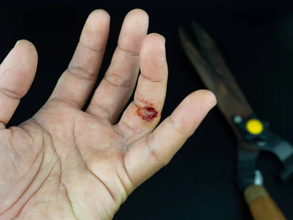 Herida Por Corte Abrasión Herida Dedo Mientras Que Uso Tijeras — Foto de Stock