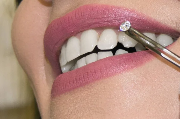 Medico Dentista Seleziona Una Gemma Strass Denti Dei Pazienti Bocca — Foto Stock