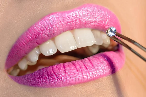 Dentist doctor examining patient  teeth, Mouth close up
