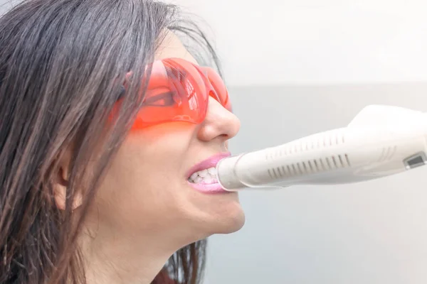 Diş Hekimindeki Bir Kızın Portresi Diş Beyazlatma Prosedürü Ultraviyole Işıkla — Stok fotoğraf