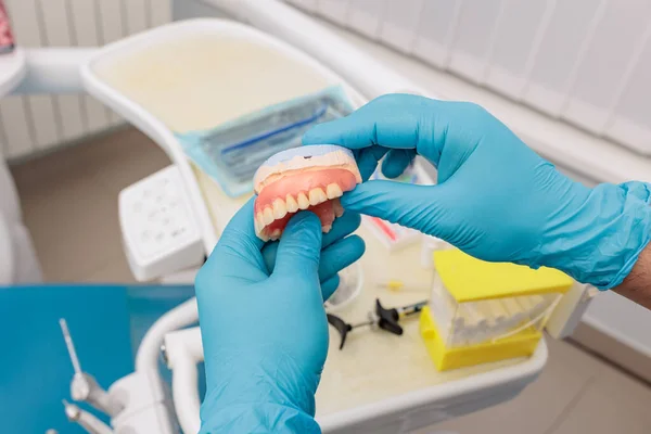 Dental prosthesis in the hands of the doctor close-up. Dentist holding ceramic dental bridge. Front view of complete denture. Dentistry conceptual photo. Prosthetic dentistry. False teeth