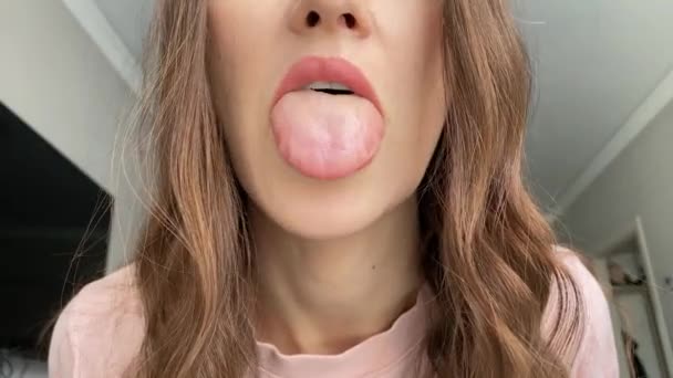 Tongue Swelling Insect Bite Wasp Bee Allergy Angioedema — Video Stock