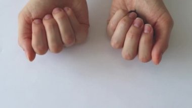 Fresh natural fruit versus pills. Woman holding raspberries and supplements. Natural vitamin in fruit versus synthetic vitamins in pills.