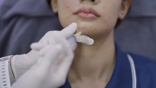 Неузнаваемый Врач Вводящий Ботокс Женское Лицо Антивозрастное Лечение Клинике Пластической — стоковое видео