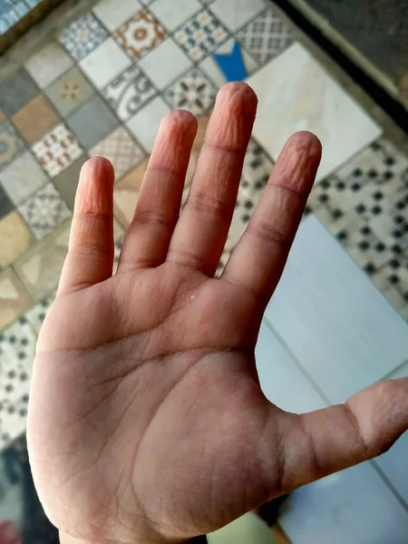 Banyo yaptıktan sonra kırışık olan bir çocuğun derisi.