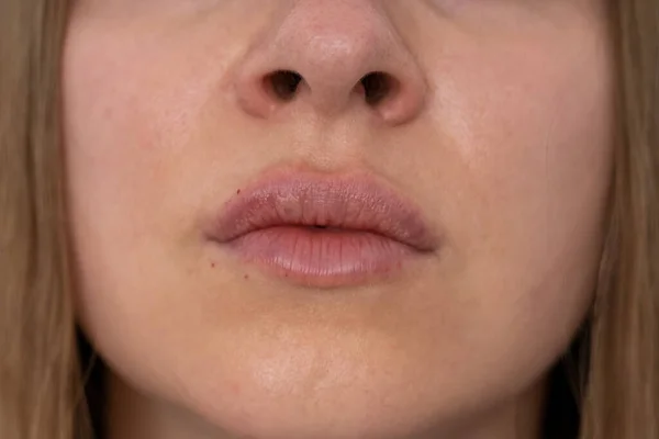 Labios Mujer Empujar Cerca Vista Después Del Procedimiento Aumento Labios —  Fotos de Stock