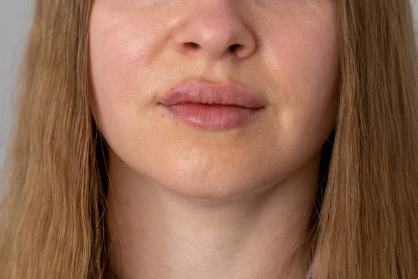 Labios Mujer Empujar Cerca Vista Después Del Procedimiento Aumento Labios —  Fotos de Stock