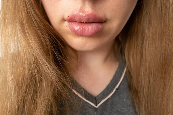 Labios Mujer Cerrar Vista Después Del Procedimiento Aumento Labios Con —  Fotos de Stock