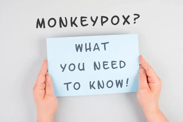 Words Monkeypox What You Need Know Standing Paper Outbreak Mpxv — Stock Photo, Image